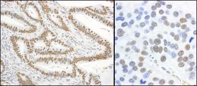 Immunohistochemistry-Paraffin: XRCC1 [p Ser485, p Thr488] Antibody [NB100-541]
